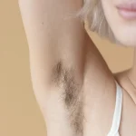 عوامل افزایش موهای زائد
