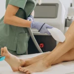 مراقبت بعد لیزر